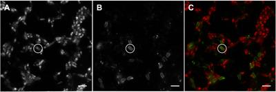 An Experimental Insight into Extracellular Phosphatases – Differential Induction of Cell-Specific Activity in Green Algae Cultured under Various Phosphorus Conditions